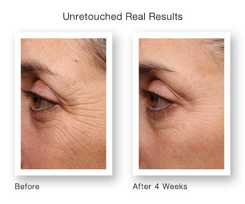 Revitalizing Retinol Radiance Serum