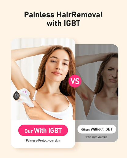 At-Home Hair Removal Device with 999,999 Flashes, 9 Energy Levels, Auto & Manual Modes