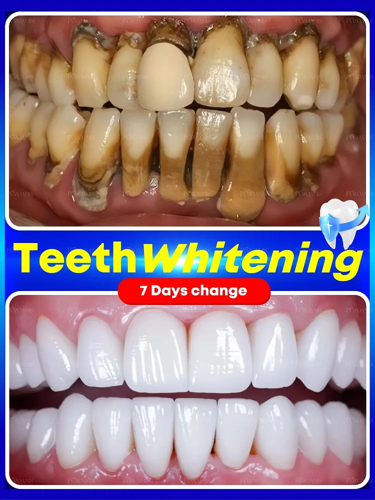 PureWhite Powder — Tooth Whitening + Plaque Removal Mineral Formula