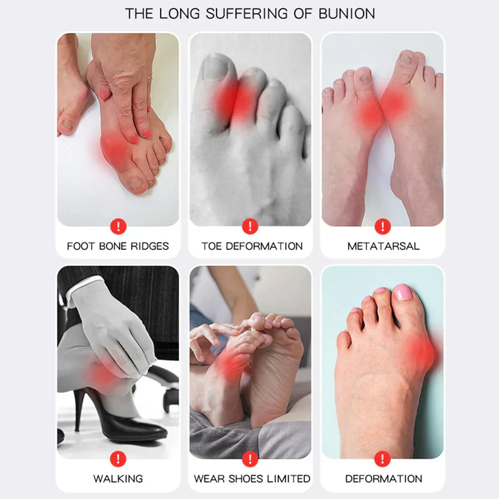 Buy One Get One Free | AlignaFeet – For Naturally Beautiful & Pain-Free Feet