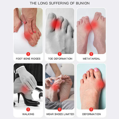 Buy One Get One Free | AlignaFeet – For Naturally Beautiful & Pain-Free Feet