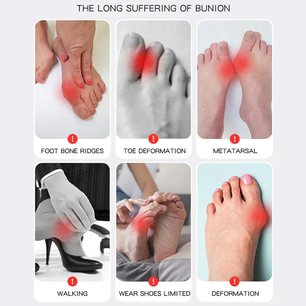 Buy One Get One Free | AlignaFeet – For Naturally Beautiful & Pain-Free Feet