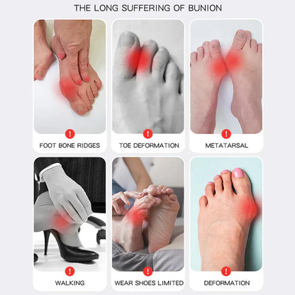 Buy One Get One Free | AlignaFeet – For Naturally Beautiful & Pain-Free Feet