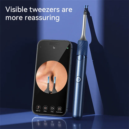 12MP Camera Ear Cleaner Tool with Wi-Fi and LED Otoscope for iPhone/Android