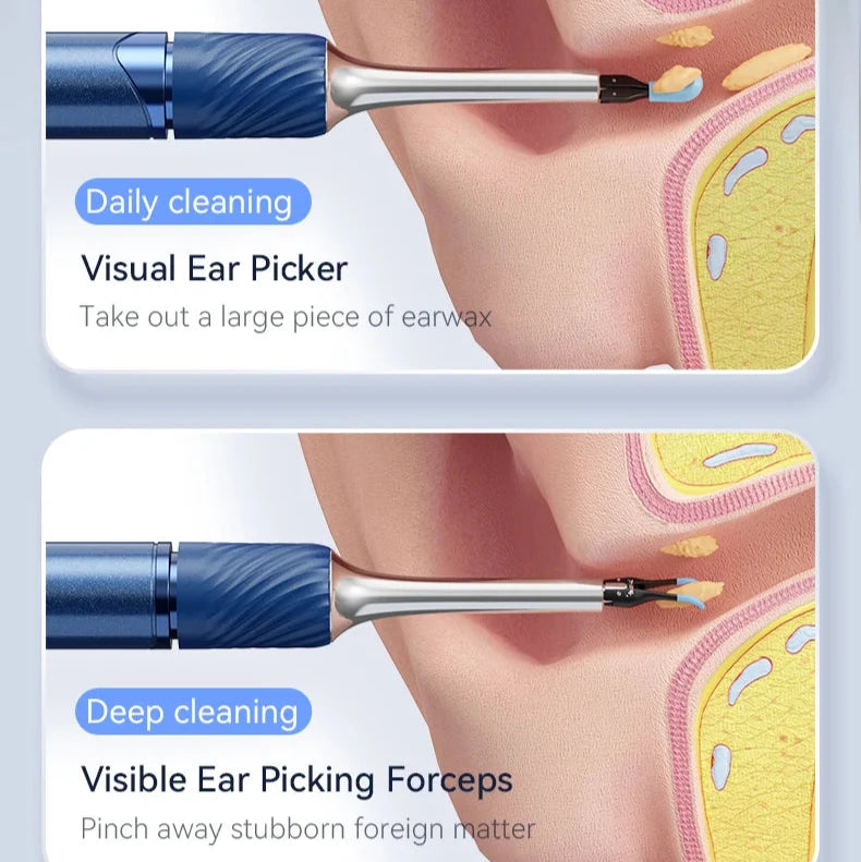 12MP Camera Ear Cleaner Tool with Wi-Fi and LED Otoscope for iPhone/Android