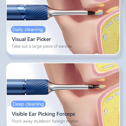 12MP Camera Ear Cleaner Tool with Wi-Fi and LED Otoscope for iPhone/Android
