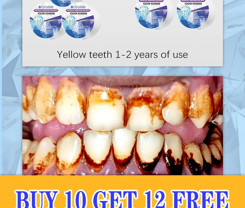 PureWhite Powder — Tooth Whitening + Plaque Removal Mineral Formula