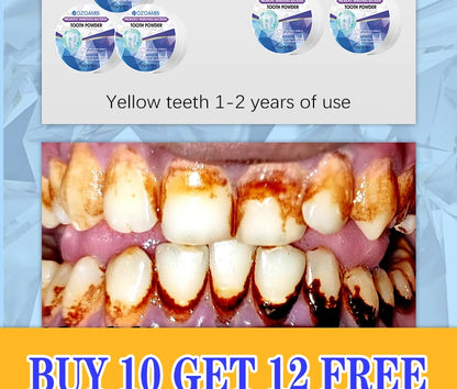 PureWhite Powder — Tooth Whitening + Plaque Removal Mineral Formula