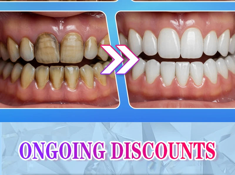PureWhite Powder — Tooth Whitening + Plaque Removal Mineral Formula
