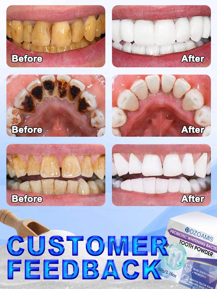 PureWhite Powder — Tooth Whitening + Plaque Removal Mineral Formula