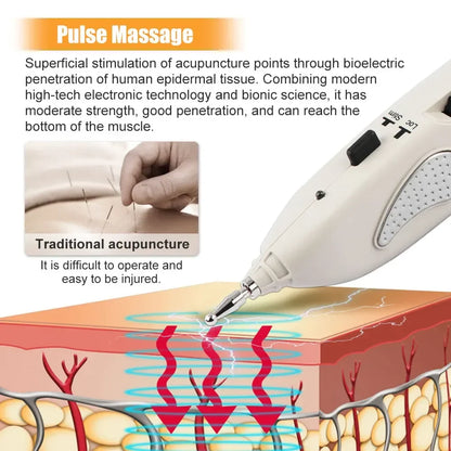 Rechargeable Massage Pen with LCD, 10 Intensity Levels, Needle-Free Tips