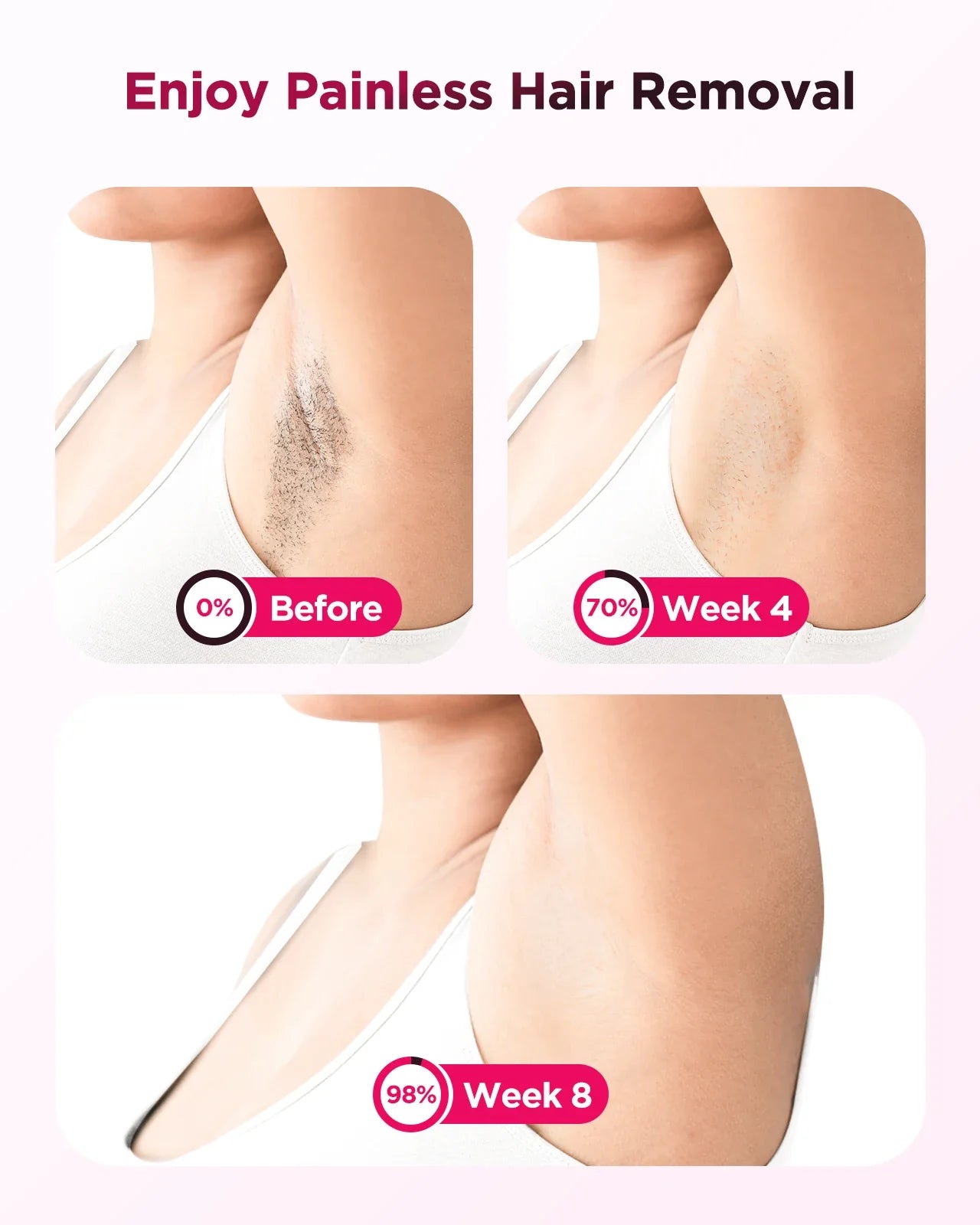 Hair Removal Device with 999,900 Flashes | 9 Energy Settings, Auto-Glide and Skin Sensor