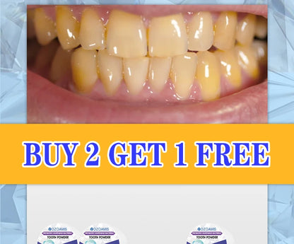 PureWhite Powder — Tooth Whitening + Plaque Removal Mineral Formula