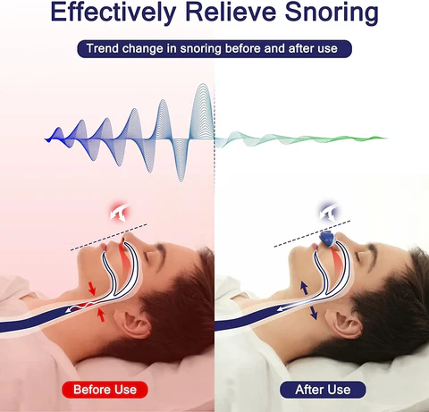 Portable Sleep Aid Device | USB Rechargeable & Mask-Free Comfort