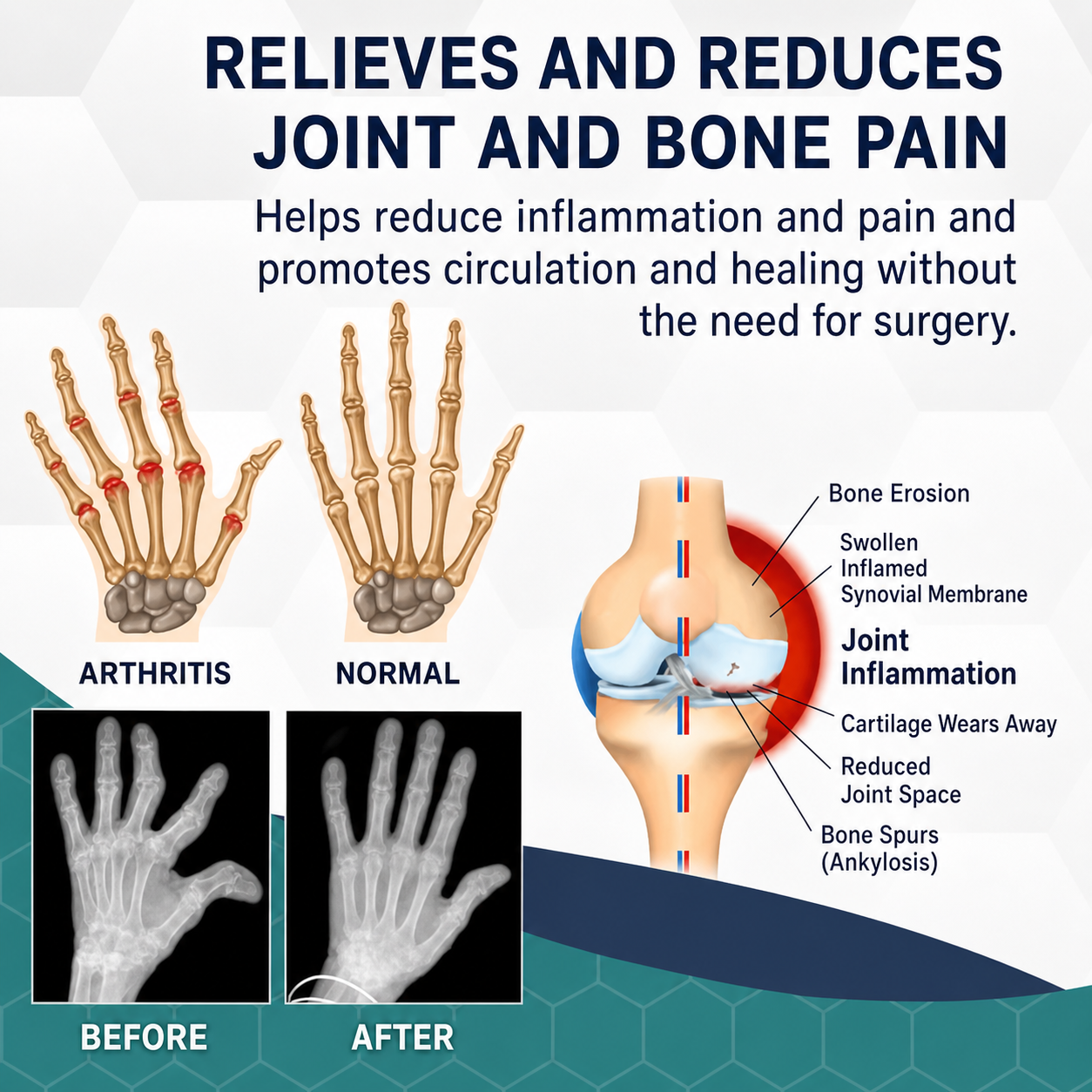 Natural Relief Cream | Harness the Power of Bee Venom for Joint Care