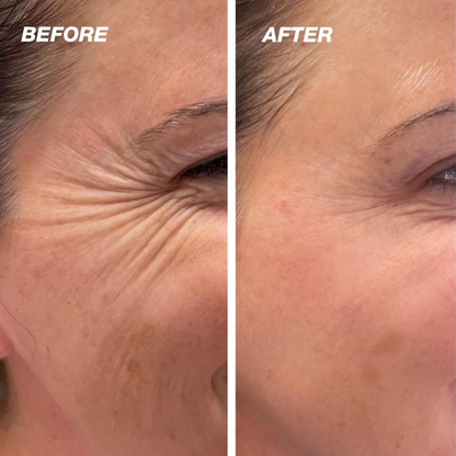 ScarAway® | Silicone Scar Treatment Sheets