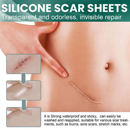 ScarAway® | Silicone Scar Treatment Sheets