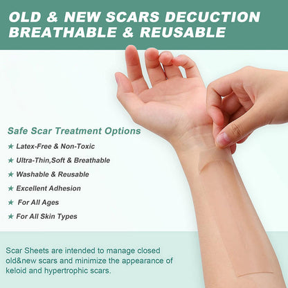 ScarAway® | Silicone Scar Treatment Sheets