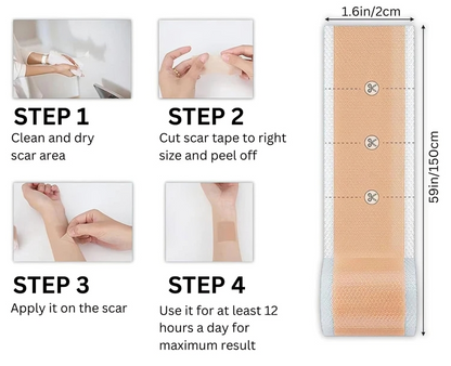 ScarAway® | Silicone Scar Treatment Sheets
