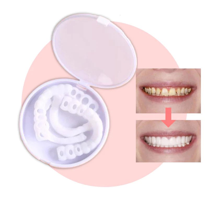 Natural Look Dental Veneers for Instant Smile Enhancement