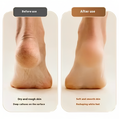 FootRevive Pro | Say Goodbye to Dry, Cracked Heels!