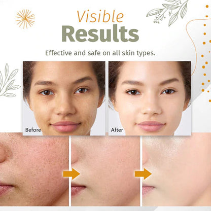 Radiant Skin Solution - Natural Serum for Flawless Complexion