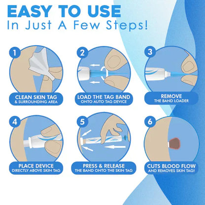 Mole Removal Kit for Skin - Eliminate Auto Skin Moles