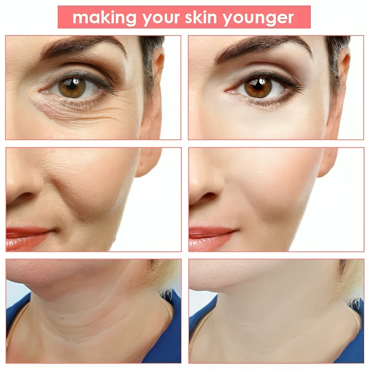 ReviveLift™ | Skin Tightening Facial Device