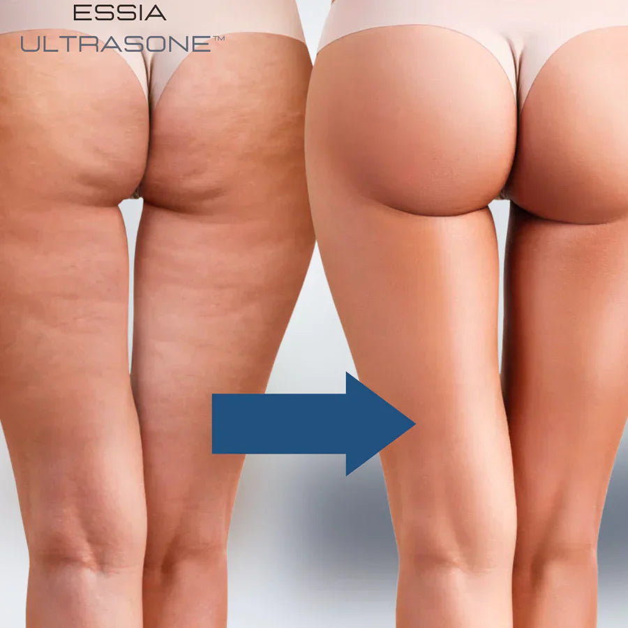 Revitalize Your Body with the New SlimTech Device!