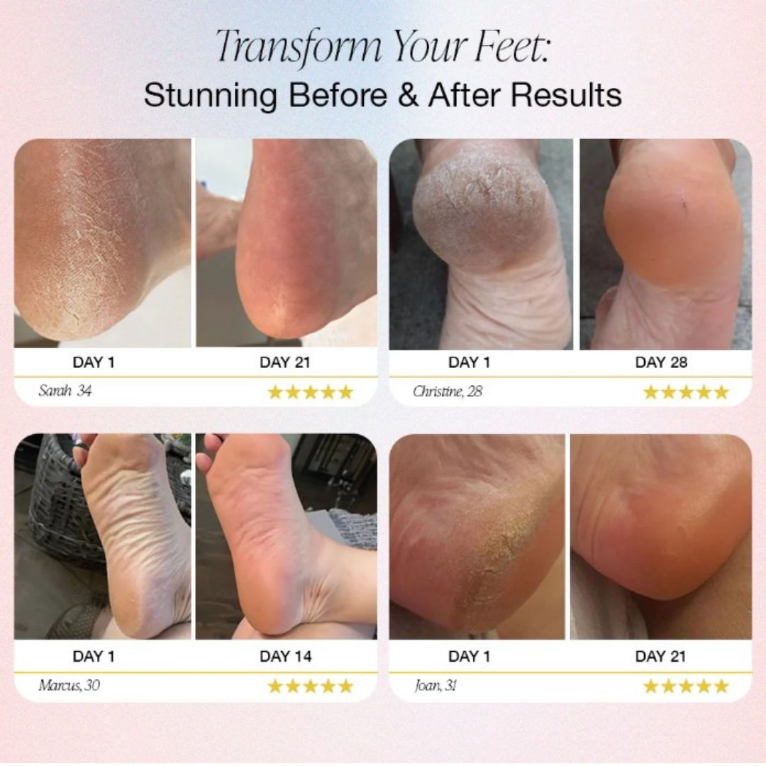 Electric Foot Care Tool for Professional Pedicure at Your Fingertips