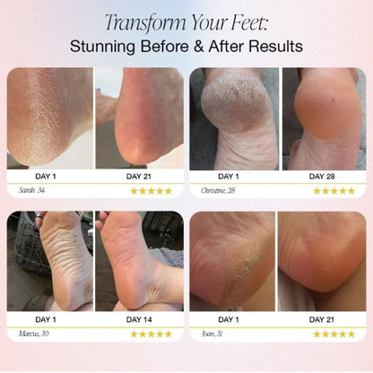 Electric Foot Care Tool for Professional Pedicure at Your Fingertips