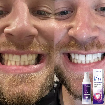 UltraBright Smile Enhancer - Color Correction Toothpaste