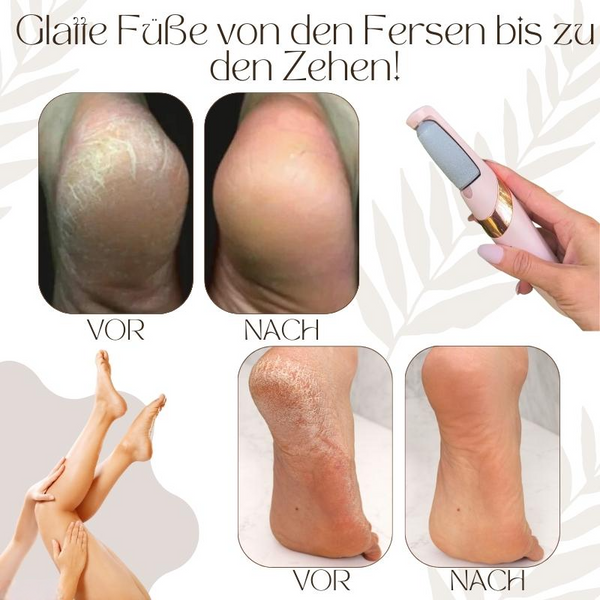 SilkSmooth — Reveal Your Perfectly Soft Feet