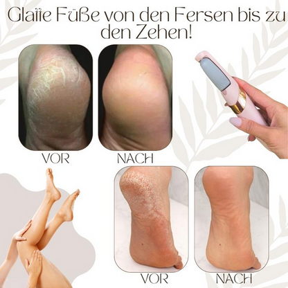 SilkSmooth — Reveal Your Perfectly Soft Feet