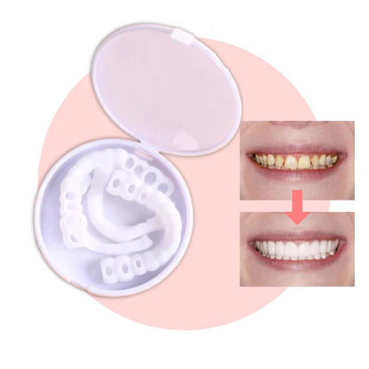 Transform Your Smile with Instant Dental Veneers