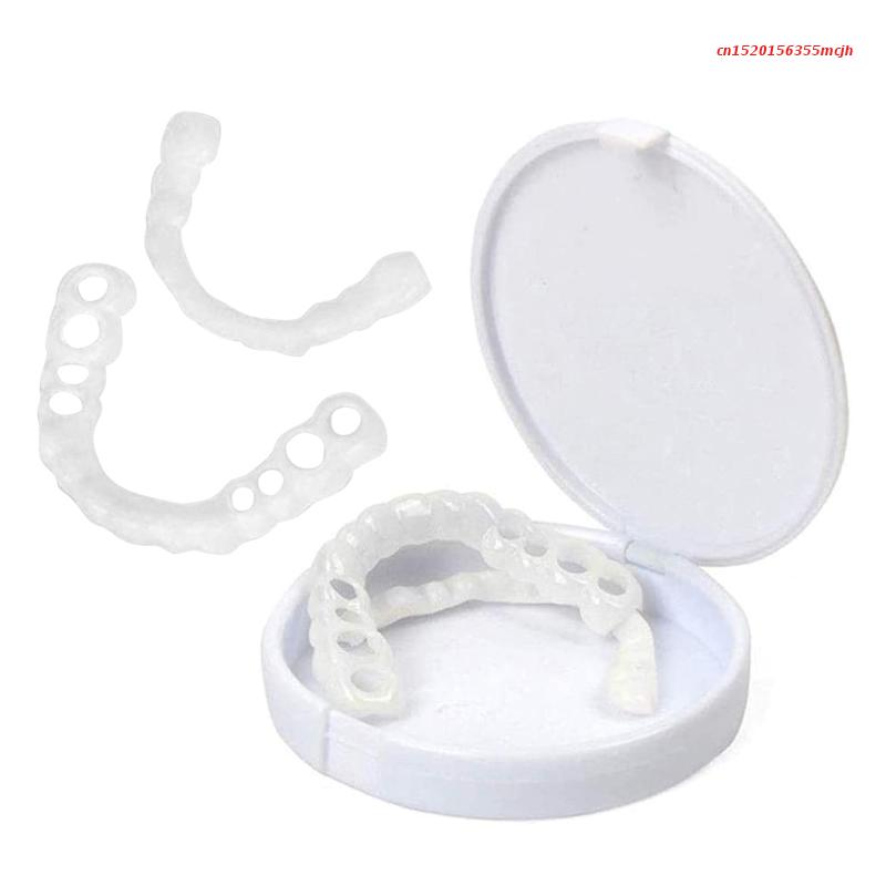 Transform Your Smile with Instant Dental Veneers