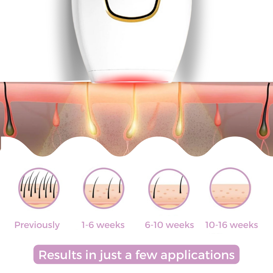 SoftLight IPL Hair Removal Device for Gentle At-Home Hair Removal