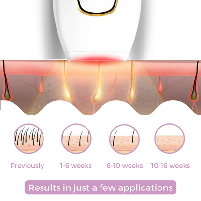 SoftLight IPL Hair Removal Device for Gentle At-Home Hair Removal
