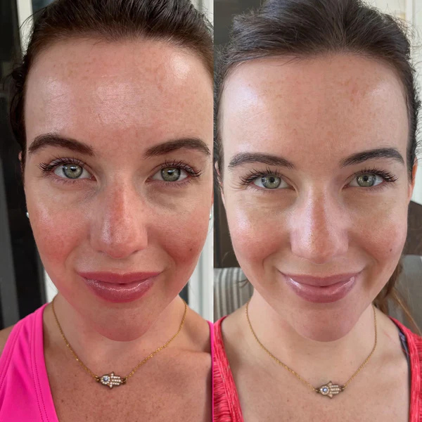 RadianceWave™ – Gentle LED Therapy for Flawless Skin