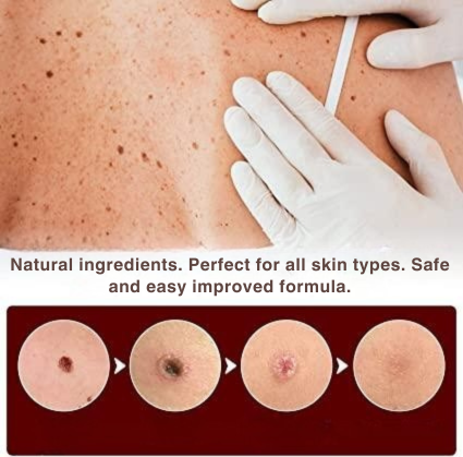 SmoothSkin Eliminator | Precision Applicator for Spot Treatment | Natural Care Formula