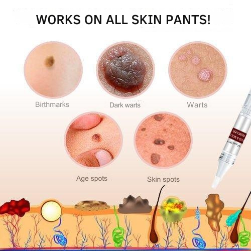 SmoothSkin Eliminator | Precision Applicator for Spot Treatment | Natural Care Formula