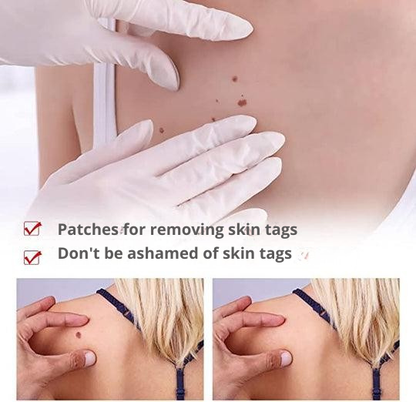 SmoothSkin Eliminator | Precision Applicator for Spot Treatment | Natural Care Formula