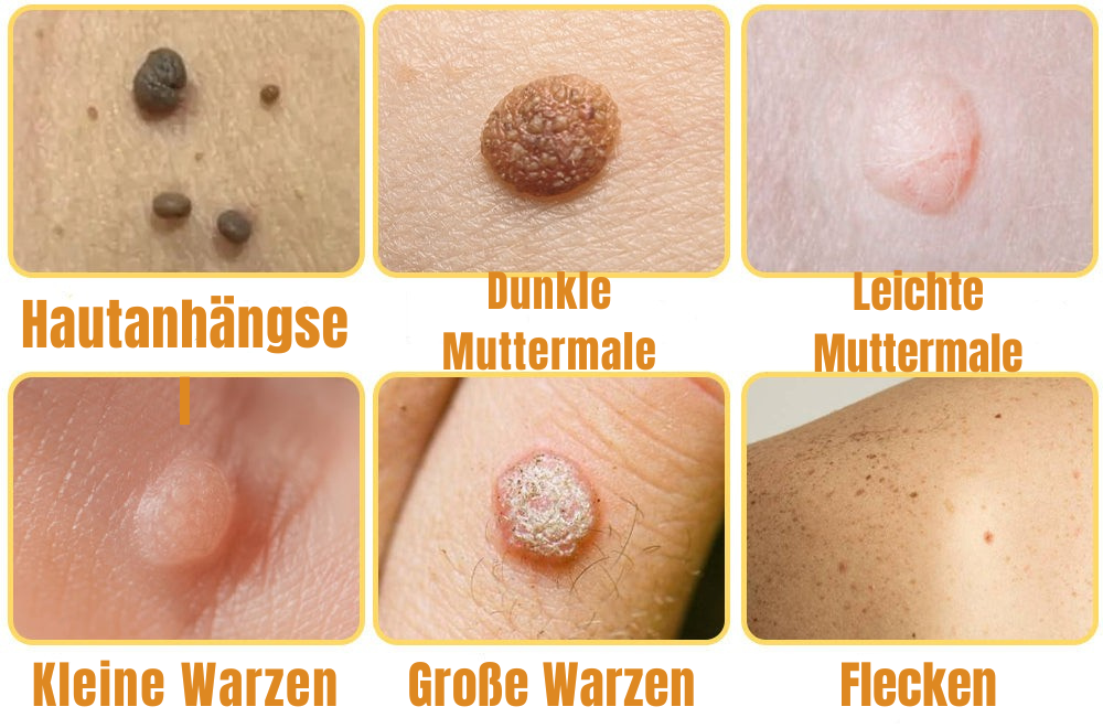 Skin Revive Solution | Wart Relief Spray | Gentle Care Formula