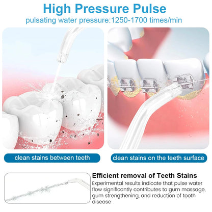 Electric Water Flosser for Gum Health, Braces & Implants – 1800 Pulses/min, 800ml Tank, 5 Tips, Adjustable Pressure