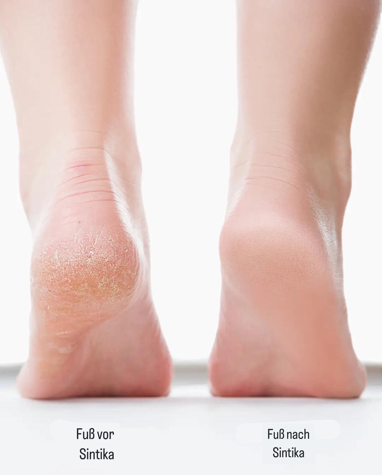 Electric Foot File for Effortless Care and Beautiful Feet