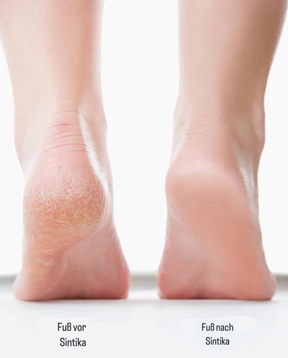 Electric Foot File for Effortless Care and Beautiful Feet