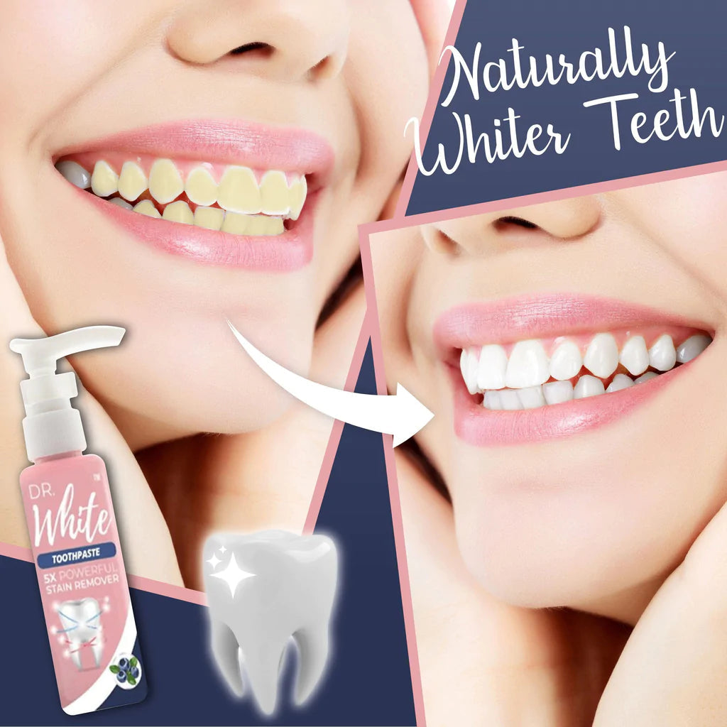 Brilliant Smile Whitening Toothpaste | Gentle Stain Remover