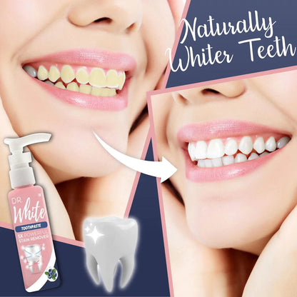 Brilliant Smile Whitening Toothpaste | Gentle Stain Remover