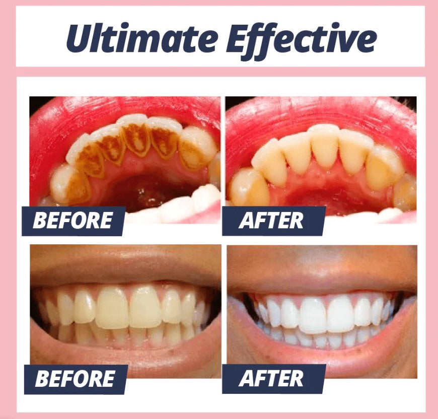 Brilliant Smile Whitening Toothpaste | Gentle Stain Remover