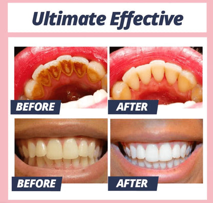Brilliant Smile Whitening Toothpaste | Gentle Stain Remover